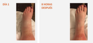 Incrediwear como tecnología innovadora para aliviar el dolor y acelerar la recuperación 5 Captura de pantalla 2023 06 05 135025 | Incrediwear como tecnología innovadora para aliviar el dolor y acelerar la recuperación