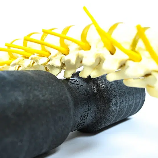 FLEXVIT PATrigger 3 FLEXVIT PATrigger - Imagen 2